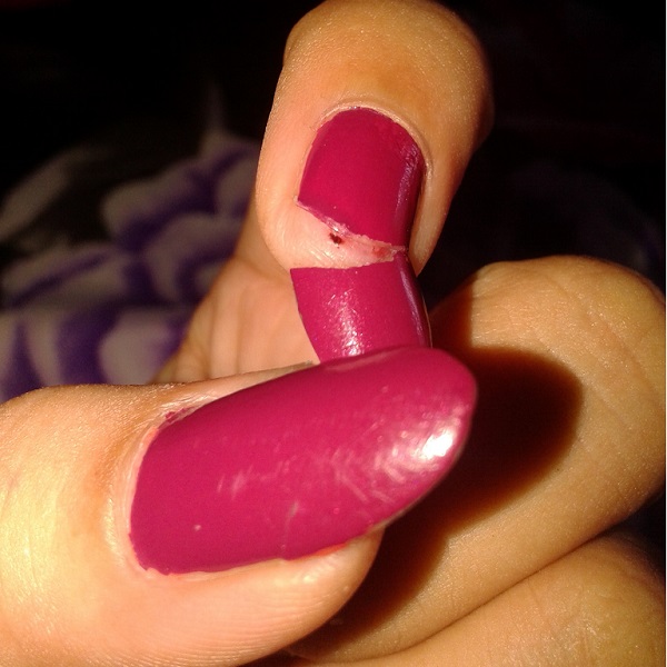 指甲翻開的英文怎麼說？